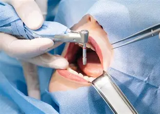 Oral & Maxillofacial Surgery